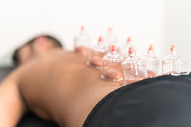 Cupping